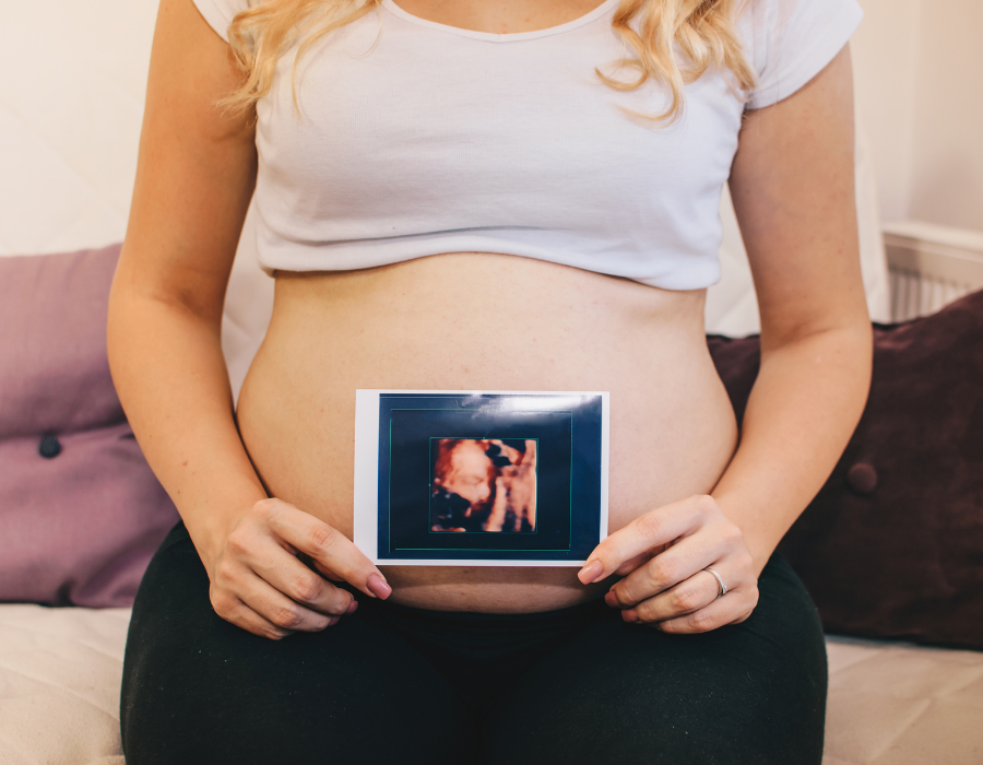 Tips to give your patients for better 3D/4D ultrasound images