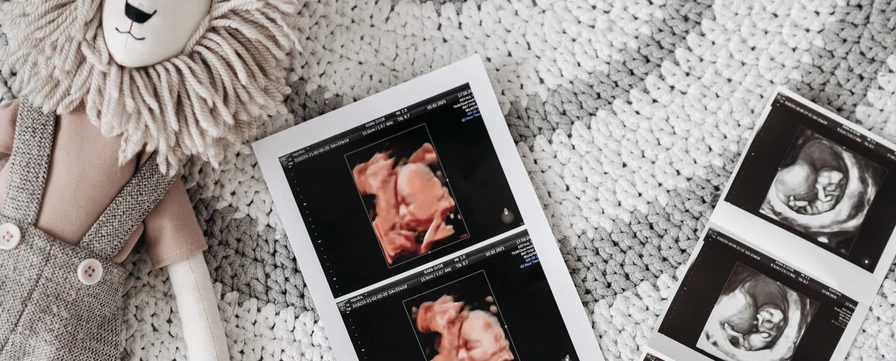 Ultrasound Paper: What You Need to Know