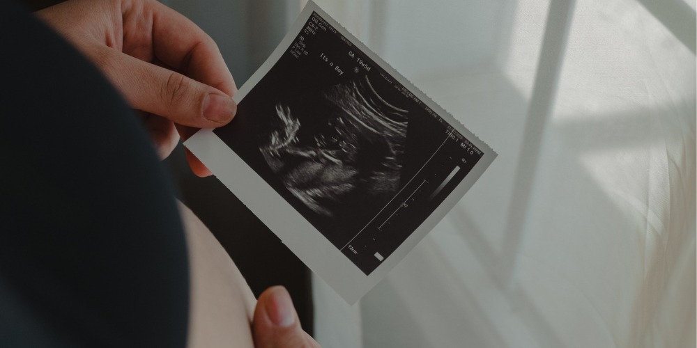 Ultrasound Printers: Translating Sound Waves into Tangible Images