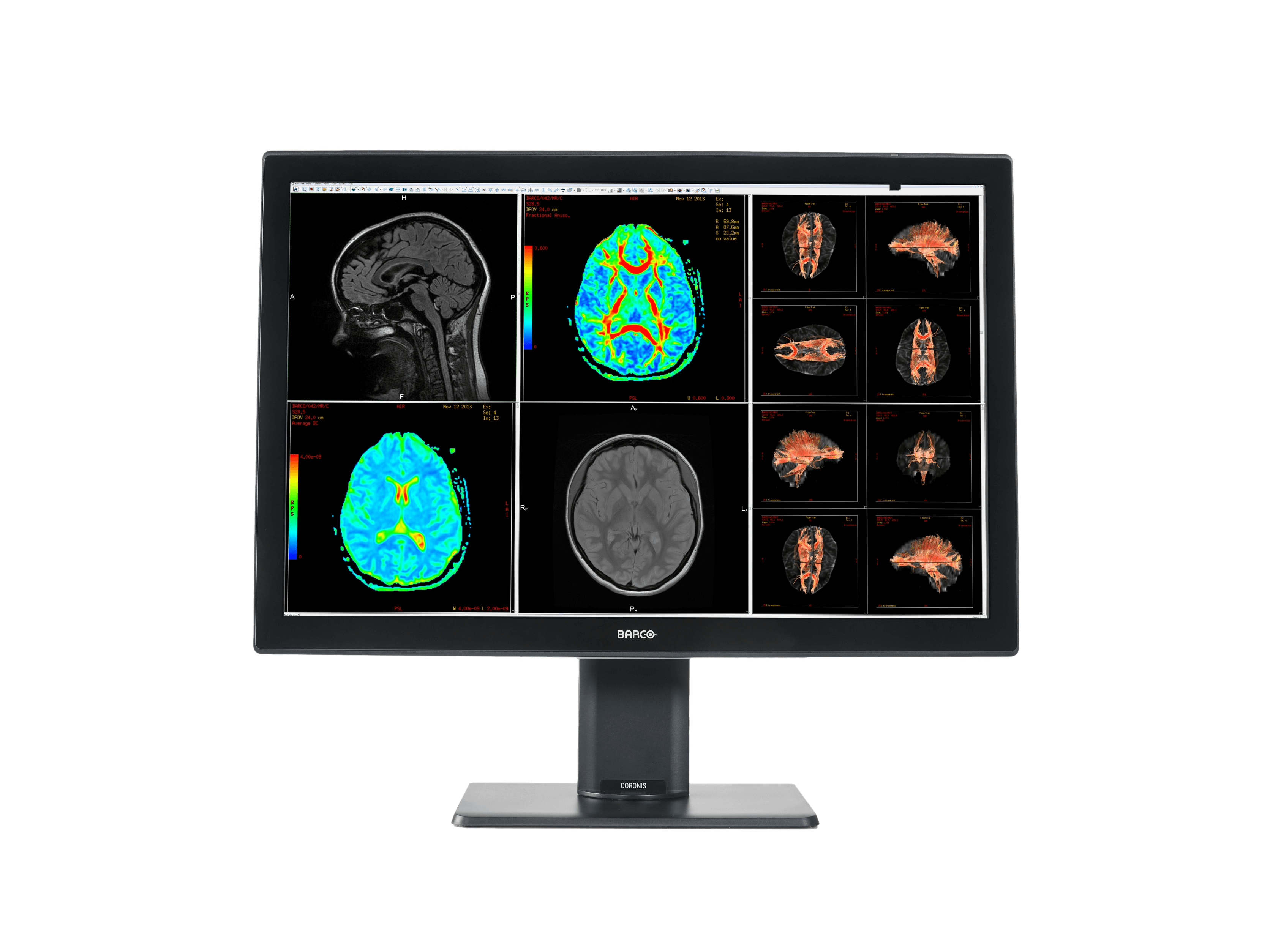 Medical monitor Coronis 4MP MDCC-4430 Color Fusion Diagnostic Display has  a resolution of 2560 x 1600 for an aspect ratio of 16:10