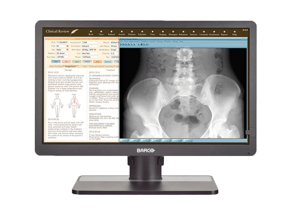 Barco's Eonis MDRC-2324 24" clinical review display offers unparalleled image quality, with LED backlight technology providing consistent brightness and a wide viewing angle