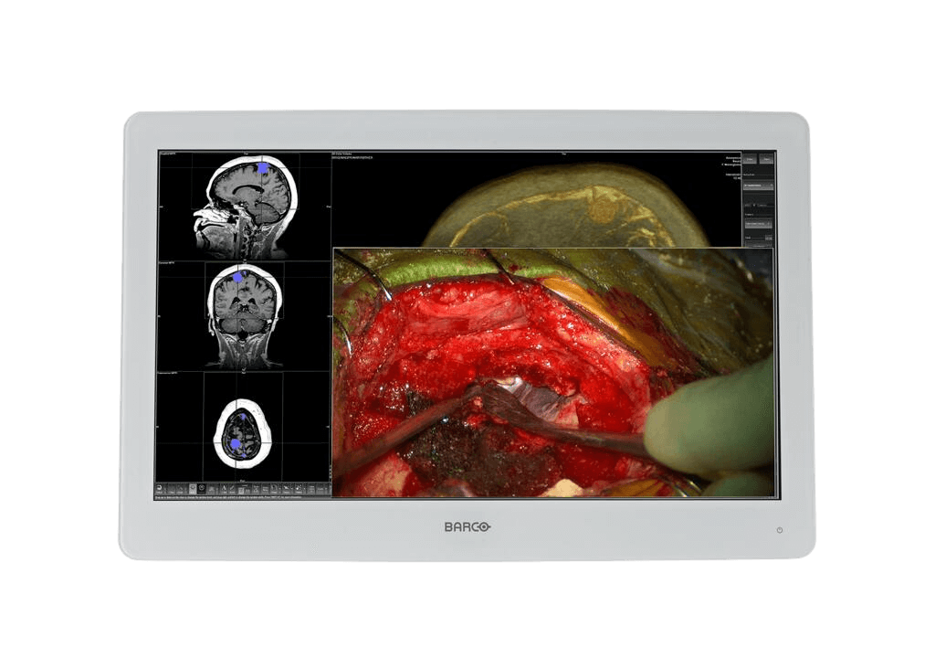 MDSC-2324 24" Full HD Surgical Display