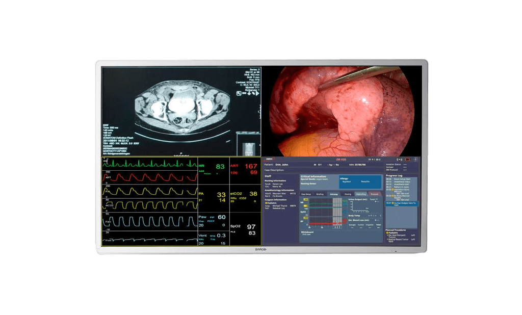 MDSC-8255 55" 12G 4K UHD Surgical Display