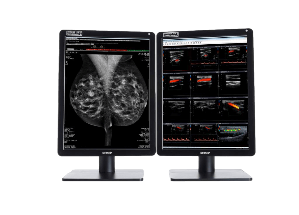 Medical monitor NIO 6MP MDNC-6121 Color Diagnostic Display is an ideal choice for radiology and mammography