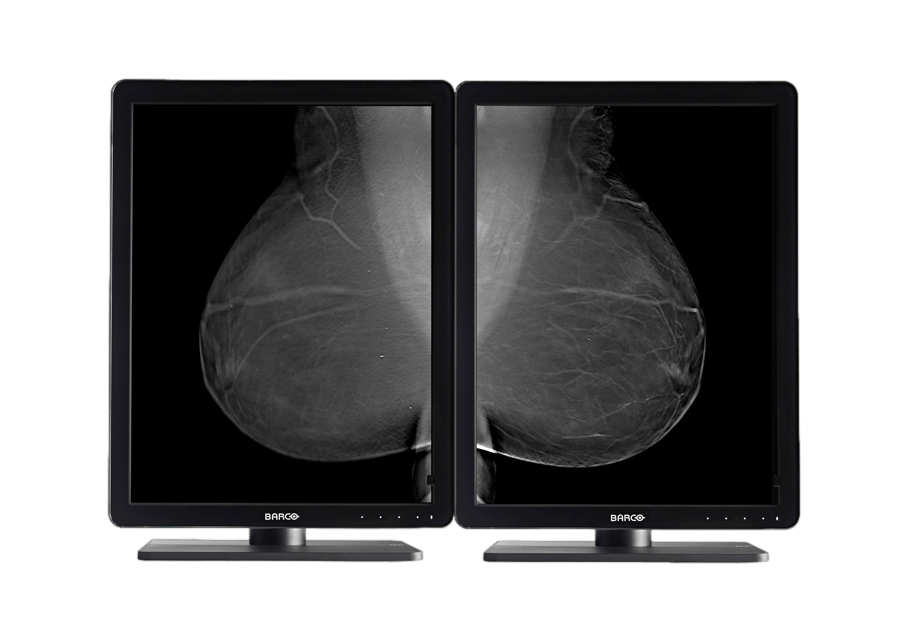 Medical monitor NIO 5MP MDNG-5221 Grayscale Diagnostic Display provides excellent image quality and performance for accurate medical diagnoses