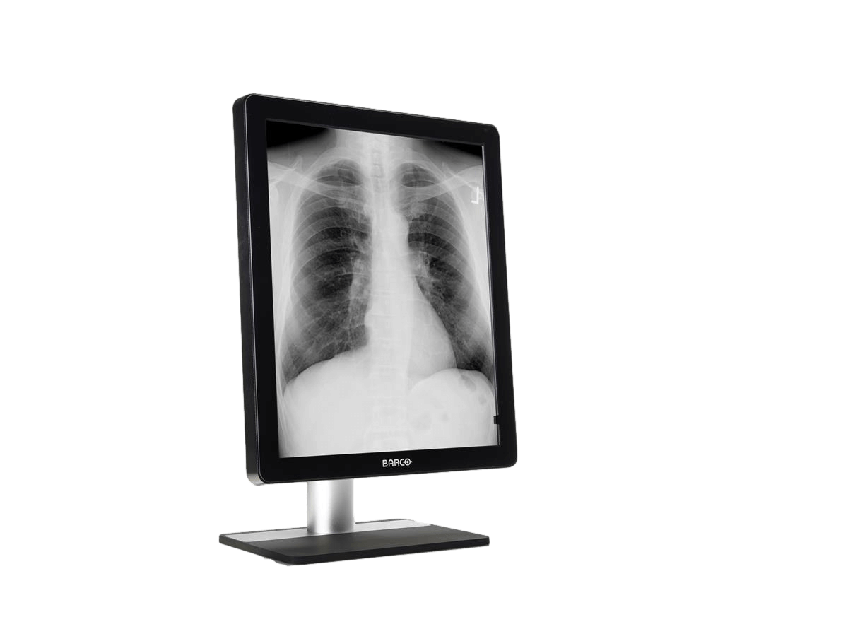 Medical monitor Coronis 5MP MDCG-5221 Grayscale Diagnostic Display can render more JND thanks to its high-brightness LED backlights