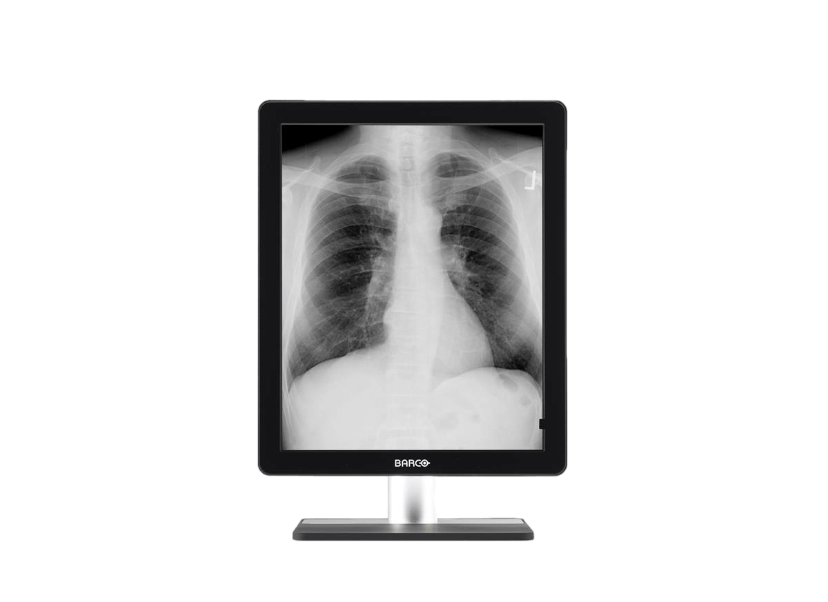Medical monitor Coronis 5MP MDCG-5221 Grayscale Diagnostic Display has a resolution of 2560 x 2048 for an aspect ratio of 5:4