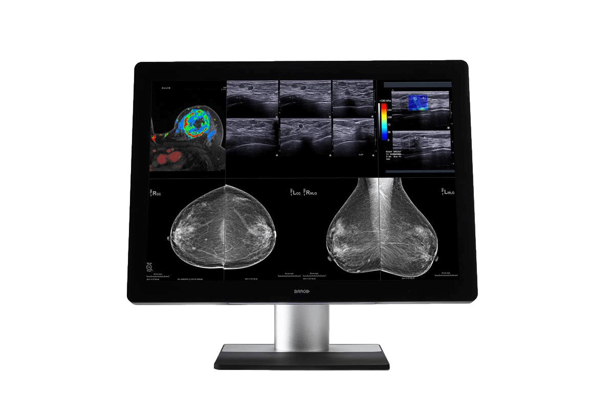 Medical monitor Coronis Uniti 12MP MDMC-12133 Color Diagnostic Display is ideal for PACS and breast imaging