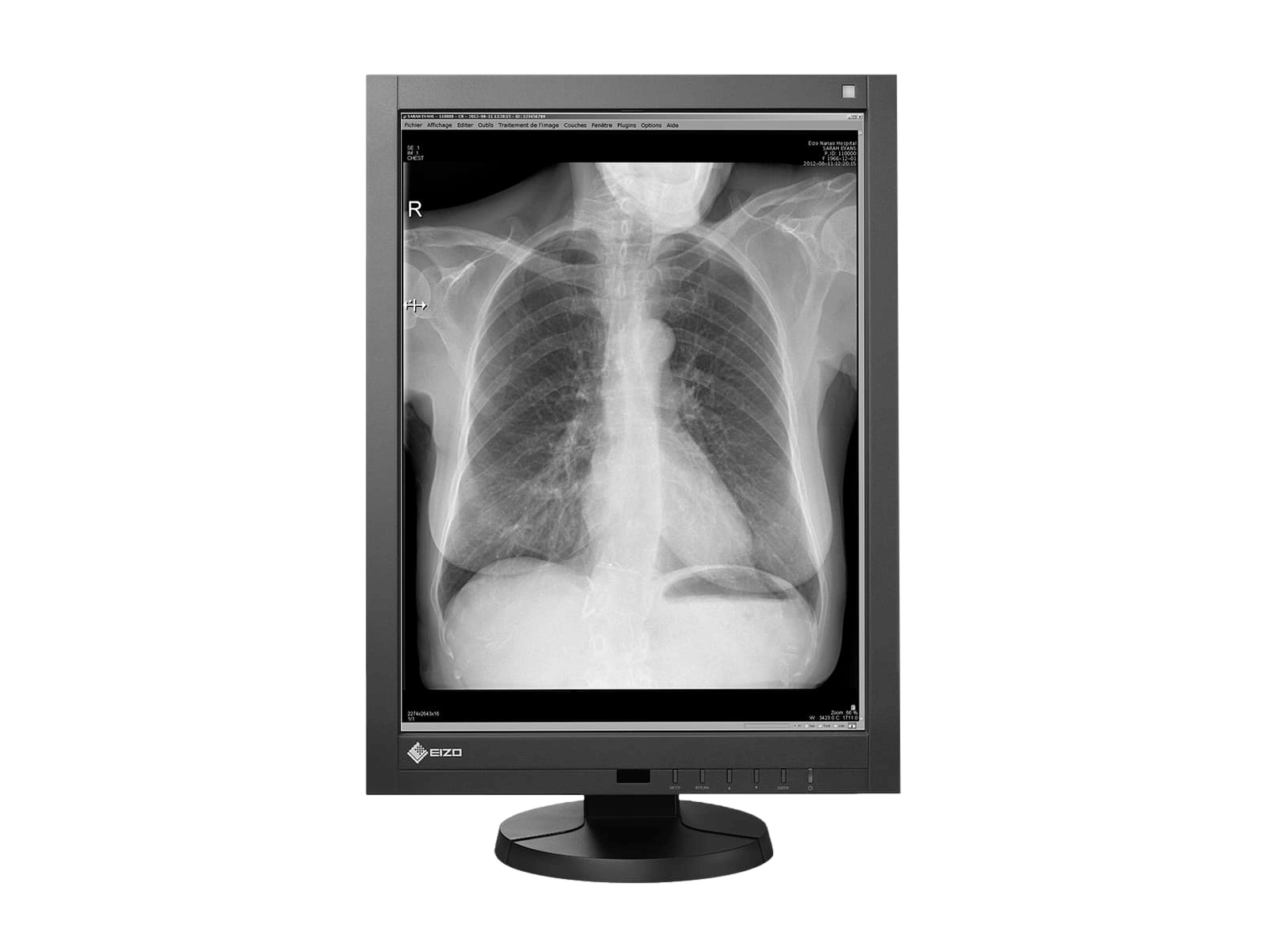 Medical monitor RadiForce GX340 3MP 21.3" LCD LED Monochrome Display is ideal for CR with its 3MP high resolution, displaying an entire chest image with great accuracy