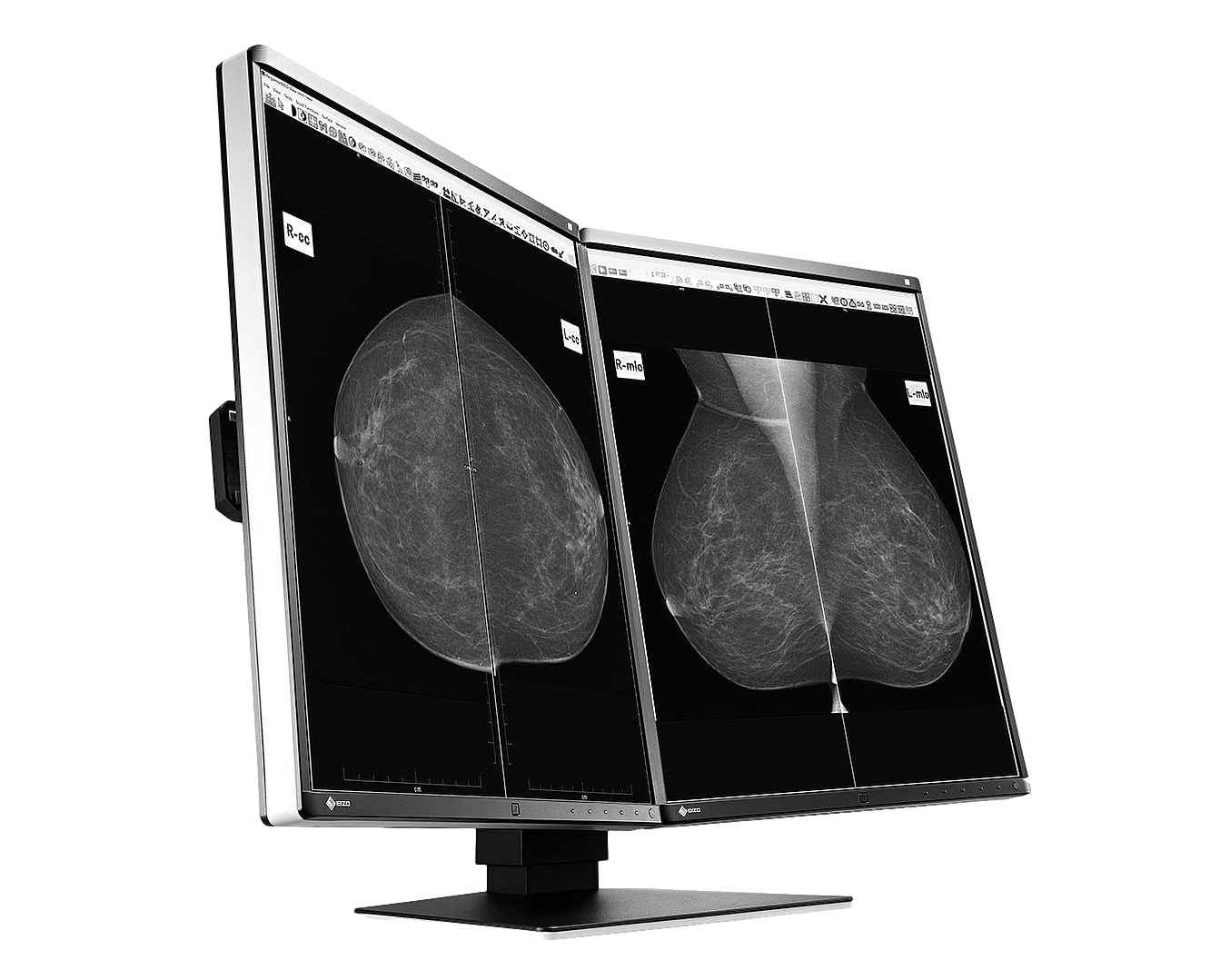 Medical monitor EIZO RadiForce GX560 5MP 21.3" LCD LED Monochrome Display is available in a dual version called MammoDuo, featuring two GX560 monitors side-by-side with a thin bezel