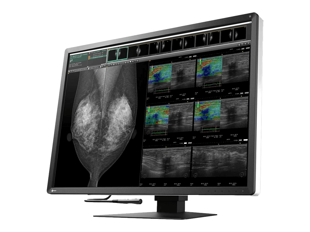 Medical monitor EIZO RadiForce RX1270 12MP 30.9" LCD LED Color Display perfect for breast tomosynthesis and mammography