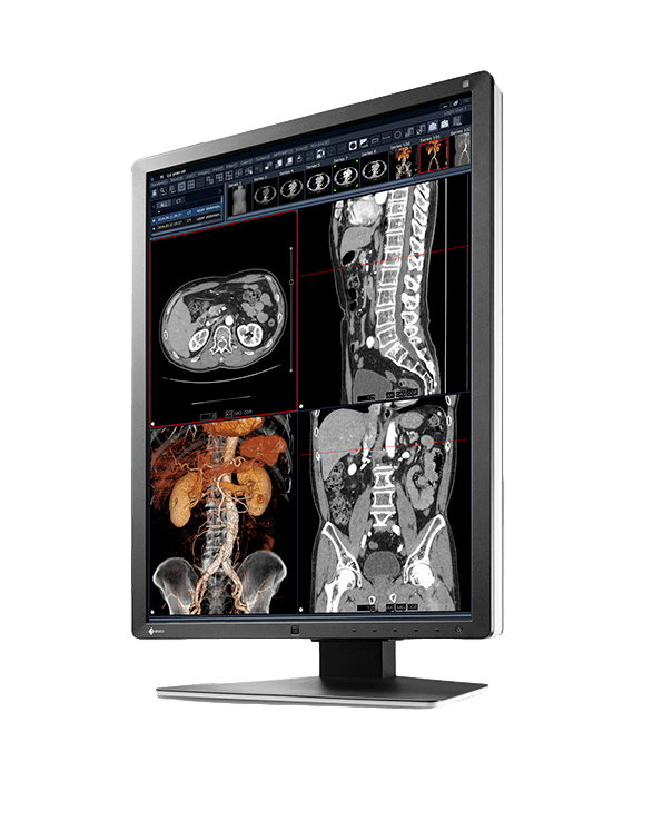 Medical monitor RadiForce RX250 2MP 21.3" LCD LED Color Display is a true hybrid monitor, displaying monochrome and color images with great precision 