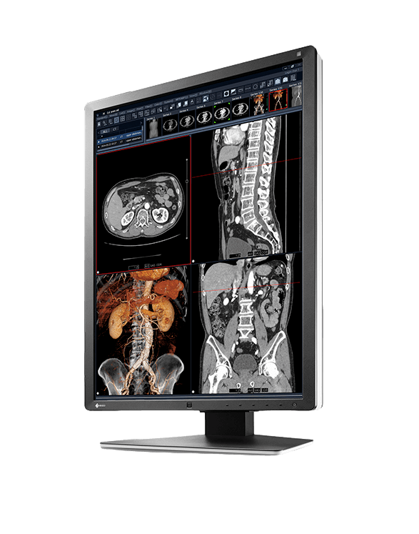 Medical monitor RadiForce RX250 2MP 21.3" LCD LED Color Display is a true hybrid monitor, displaying monochrome and color images with great precision