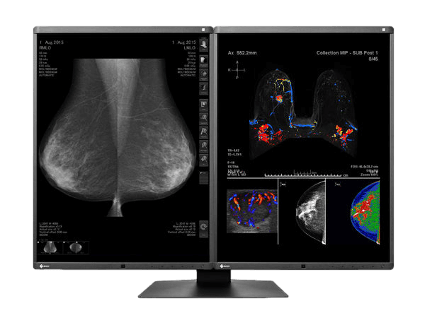 Medical monitor EIZO RadiForce RX560 5MP 21.3" LCD LED Color Display has a built-in front sensor for easy calibration