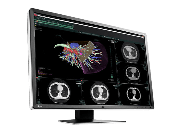 Medical monitor RadiForce RX660 6MP 30" LCD LED Color Display: the ideal choice for radiology departments