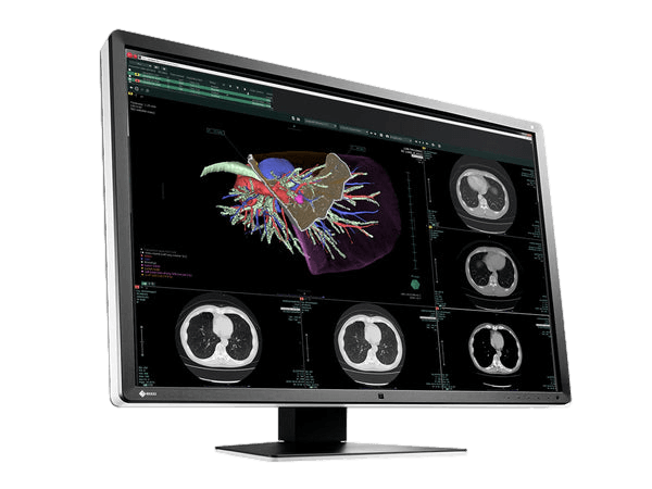 Medical monitor RadiForce RX660 6MP 30" LCD LED Color Display: the ideal choice for radiology departments 