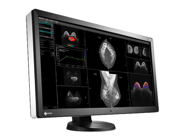 Medical monitor EIZO RadiForce RX850 8MP 31.1" LCD LED Color Display perform particularely well for viewing various medical images including digital mammography, MRI, and ultrasound