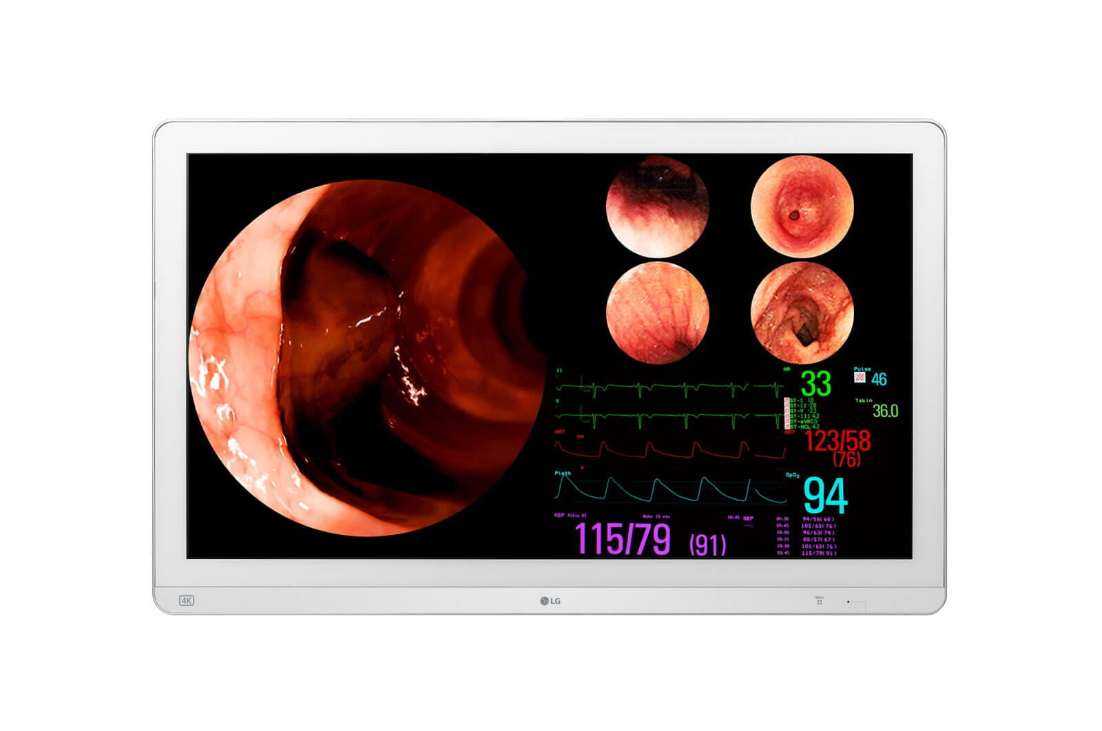 Medical monitor LG 32HL710S-W 31.5" 4K LED Surgical Display supports HDR10