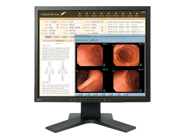 The RadiForce MX194 19" TFT LCD Clinical Review Color Display provides consistent image clarity for precise diagnosis.