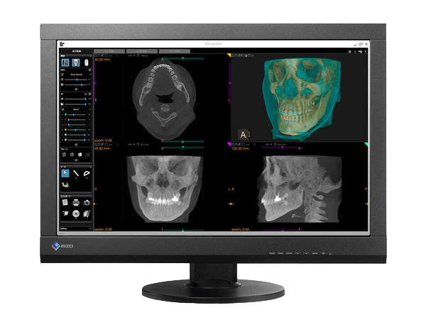 The RadiForce MX242W 24.1" TFT LCD Clinical Review Color Display is an ideal choice for medical professionals who need precision and accuracy in the diagnosis of their patients