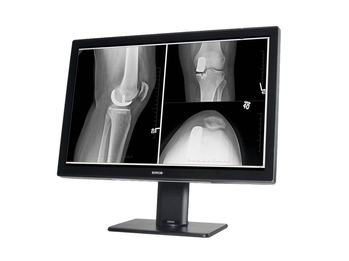 Medical monitor Coronis 4MP MDCC-4430 Color Fusion Diagnostic Display is an ideal choice for radiologists 