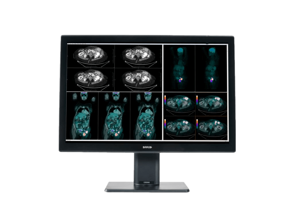 Medical monitor Coronis 4MP MDCC-4430 Color Fusion Diagnostic Display is validated with the latest workstations and with all major PACS applications 