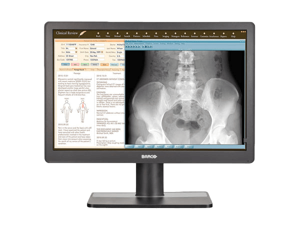 Barco Eonis 22" MDRC-2222 clinical review display offers healthcare professionals the best combination of image quality and design