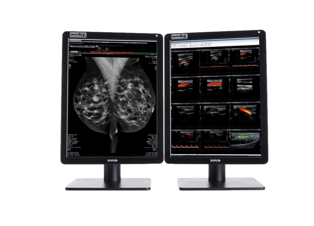 Medical monitor NIO 6MP MDNC-6121 Color Diagnostic Display is an ideal choice for radiology and mammography 