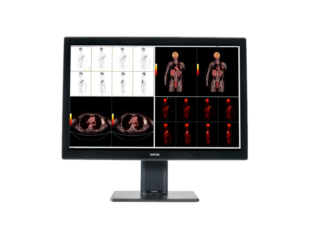 Medical monitor Coronis 6MP MDCC-6530 Color Fusion Diagnostic Display is validated with all majors PACS and latest workstations