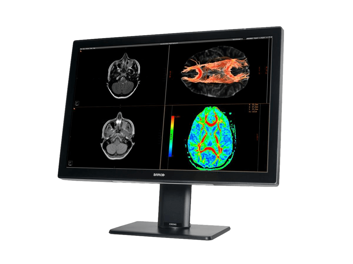 Medical monitor Coronis 6MP MDCC-6530 Color Fusion Diagnostic Display can assure Quality Assurance and compliance tasks with no human interaction necessary 