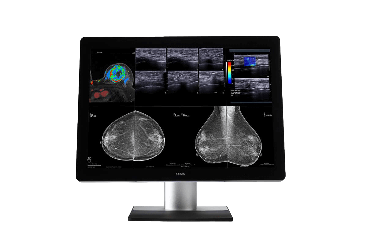Medical monitor Coronis Uniti 12MP MDMC-12133 Color Diagnostic Display is ideal for PACS and breast imaging 