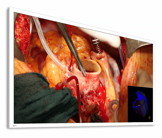 CuratOR EX5841 58" Ultra HD 4K LED Surgical Display
