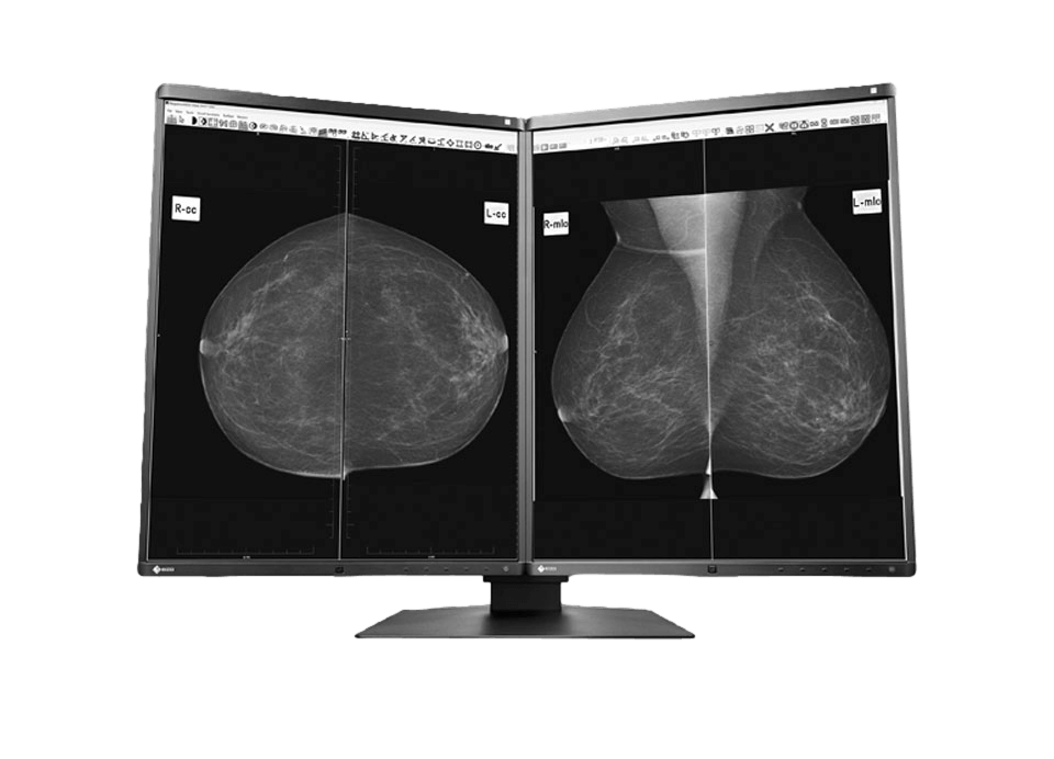 Medical monitor EIZO RadiForce GX560 5MP 21.3" LCD LED Monochrome Display in the MammoDuo format let you change the two monitors height, tilt and swivel without separating them 