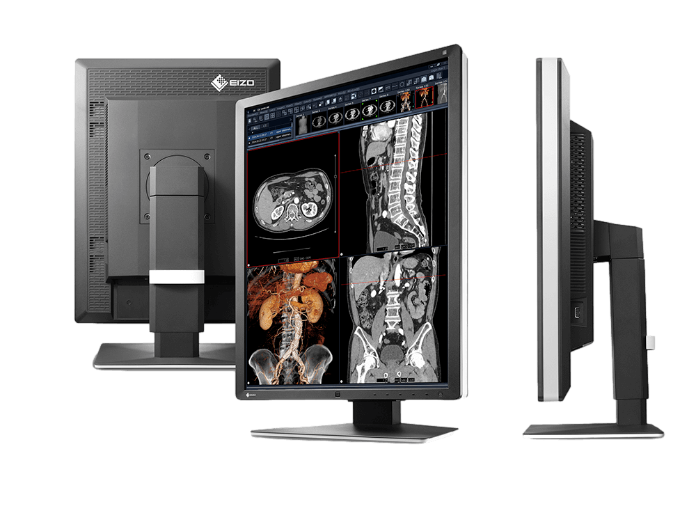 Medical monitor RadiForce RX250 2MP 21.3" LCD LED Color Display combining stunning images and high comfort 