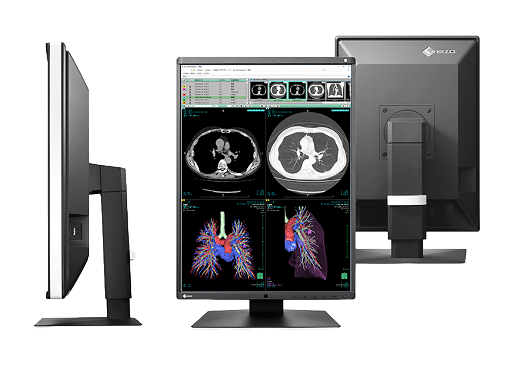 Medical monitor RadiForce RX360 3MP 21.3" LCD LED Color Display displays both monochrome and color images with great accuracy 