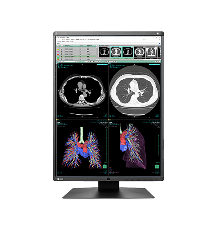 Medical monitor RadiForce RX360 3MP 21.3" LCD LED Color Display is one of the most reliable display we offer for radiology