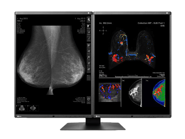 Medical monitor EIZO RadiForce RX560 5MP 21.3" LCD LED Color Display has a built-in front sensor for easy calibration 