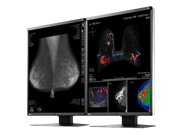 Medical monitor EIZO RadiForce RX560 5MP 21.3" LCD LED Color Display can detect when the user is away and when he comes back to use power save mode