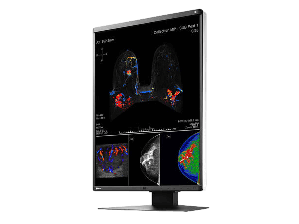 Medical monitor EIZO RadiForce RX560 5MP 21.3" LCD LED Color Display meet medical, safety, and EMC emission standards. 