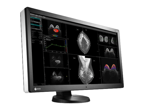 Medical monitor EIZO RadiForce RX850 8MP 31.1" LCD LED Color Display perform particularely well for viewing various medical images including digital mammography, MRI, and ultrasound 