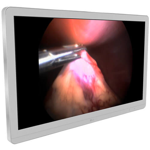 Medical display LG 27HJ713S-W Surgical Monitor has low input lag and quick response time with the Dynamic Sync Mode at 60Hz