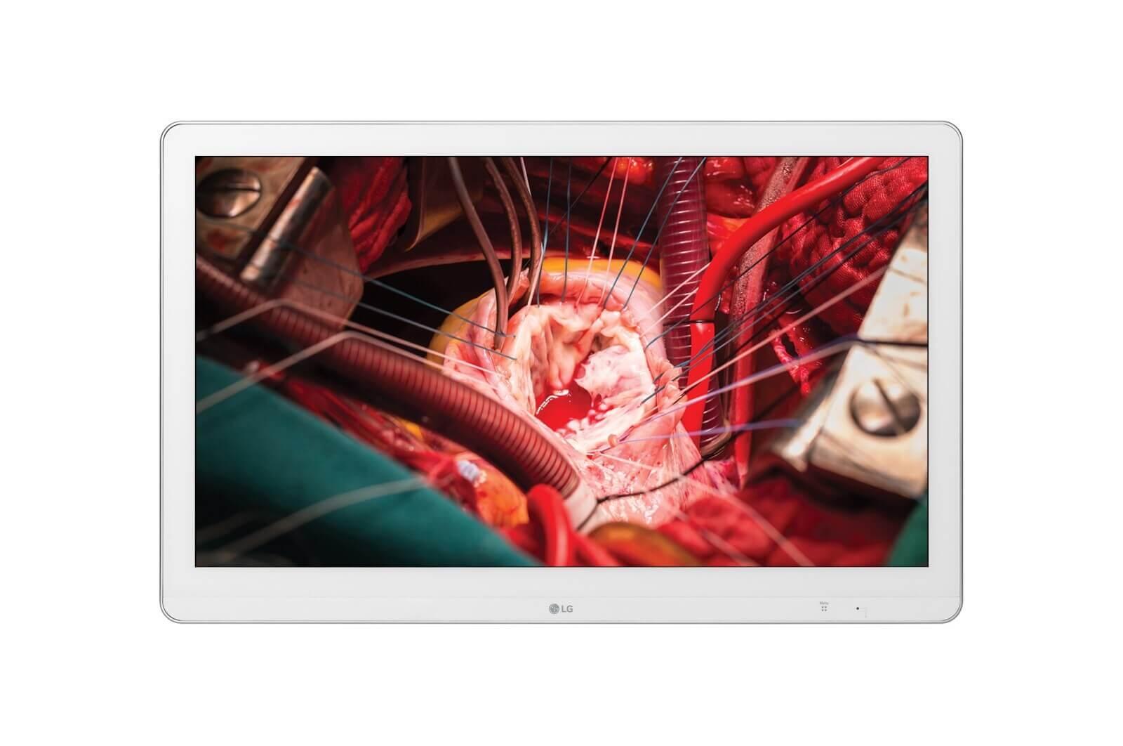 Medical display LG 27HK510S-W Surgical Monitor features a resolution of 1920 x 1080 