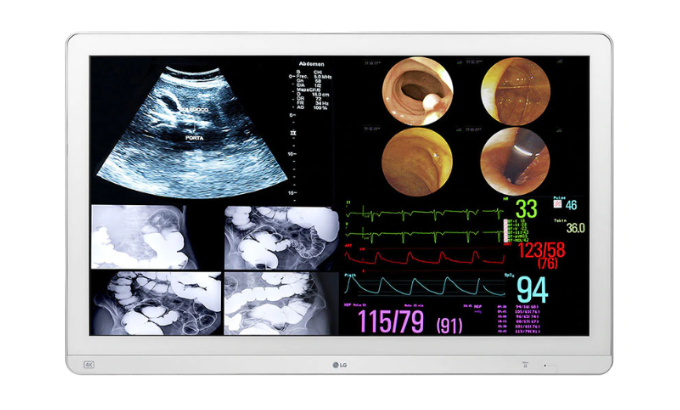 The LG 32HL714S-W 31.5'' 4K IPS Surgical Monitor is available at ERI