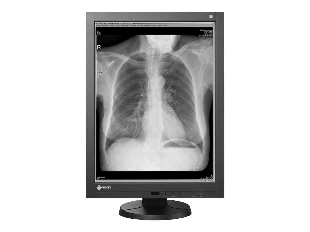 Medical monitor RadiForce GX240 2MP 21.3" LCD LED Monochrome Display performs with a wide variety of tasks from viewing CR, DR, MRI, and CT images