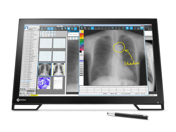 The RadiForce MS236WT 23" Multi Touch TFT LCD Clinical Review Color Display is an ideal solution for clinical reviews