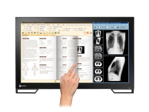 The RadiForce MS236WT 23" Multi Touch TFT LCD Clinical Review Color Display is an ideal solution for clinical reviews