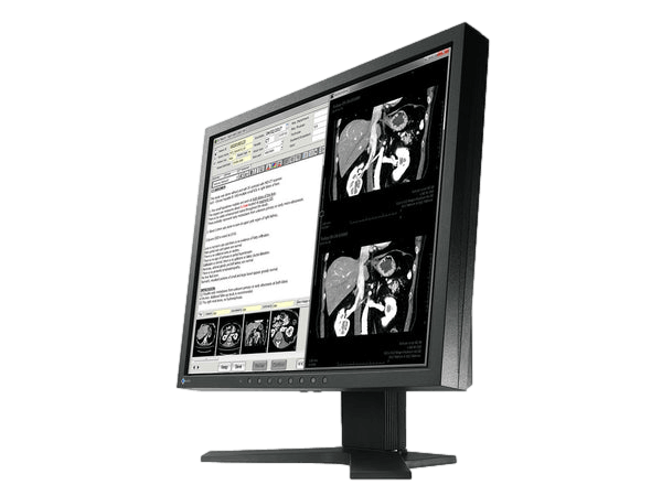 The RadiForce MX194 19" TFT LCD Clinical Review Color Display provides consistent image clarity for precise diagnosis.