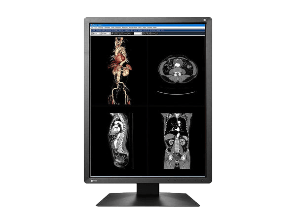The RadiForce MX216 21" TFT LCD Clinical Review Color Display is an efficient workspace-saving monitor designed for the clinical environment.
