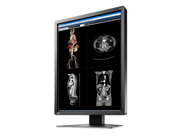 The RadiForce MX216 21" TFT LCD Clinical Review Color Display is an efficient workspace-saving monitor designed for the clinical environment.