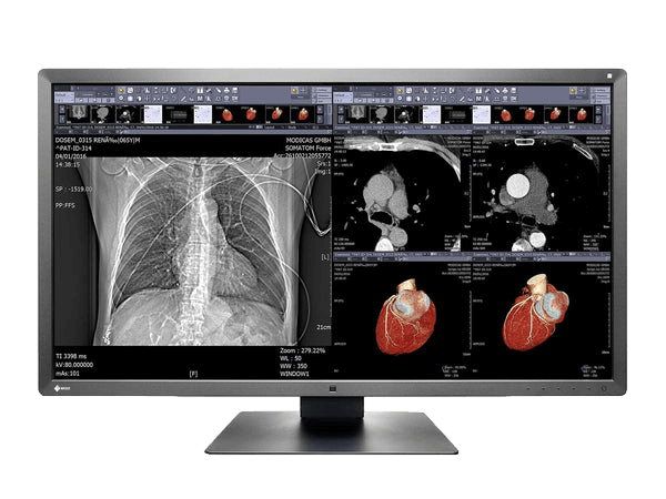 The RadiForce MX315W 31.1" TFT LCD Clinical Review Color Display is designed for medical professionals